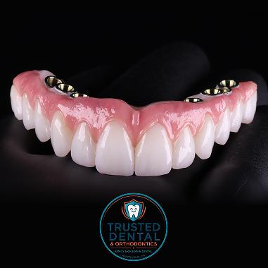 Zirconia Implant Bridge